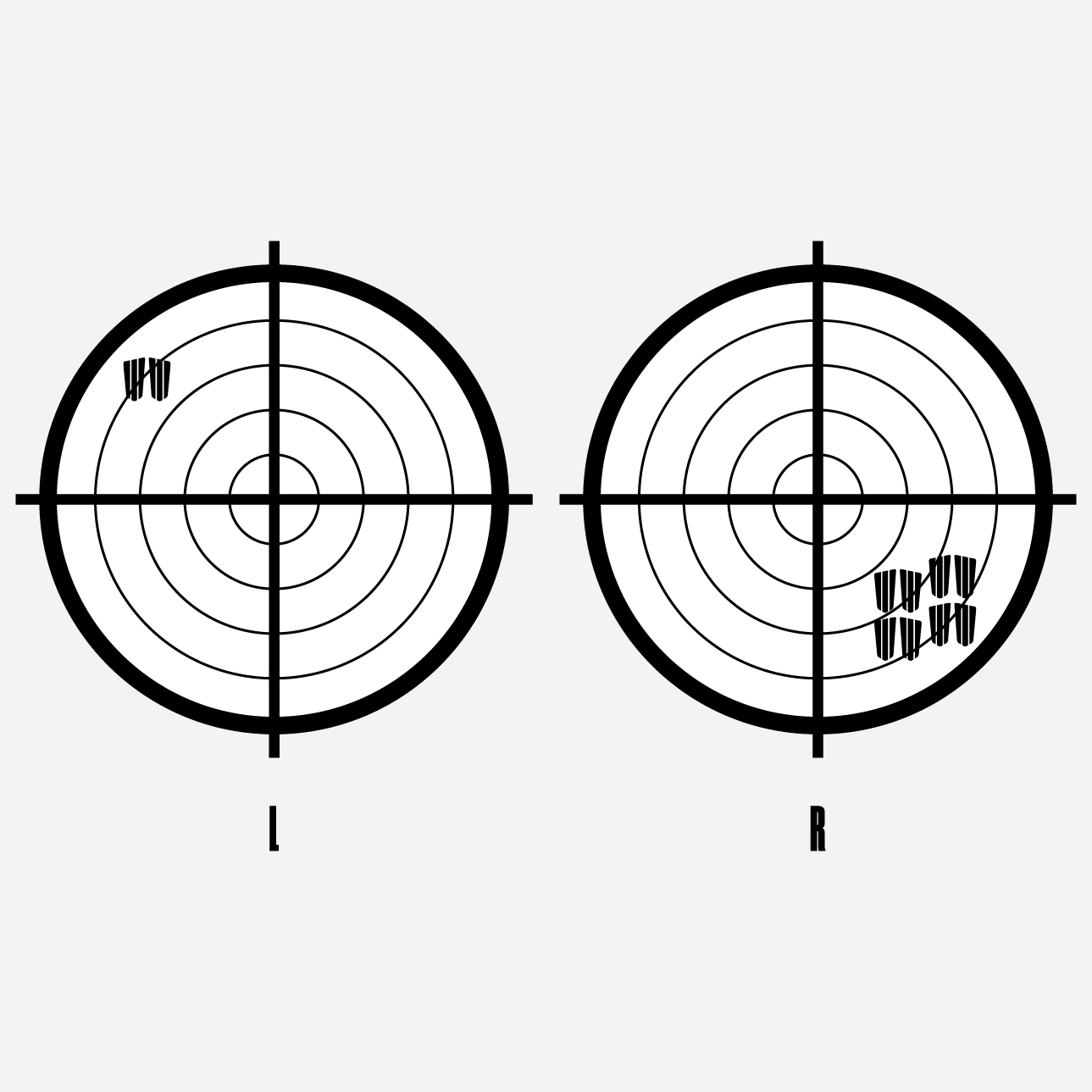 EYE-EXAMINATION-GRAPHICS_CUTLER-AND-GROSS_3-1